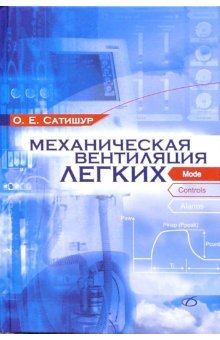 Механическая вентиляция легких