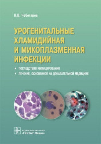 Урогенитальные хламидийная и микоплазменная инфекции.Последствия инфицирвания