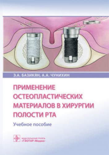 Применение остеопластических материалов в хирургии полости рта