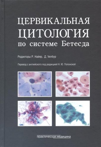 Цервикальная цитология по системе Бетесда.Термин