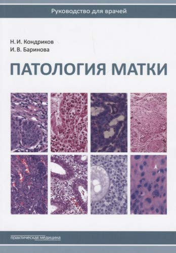 Патология матки.Руководство для врачей.2изд