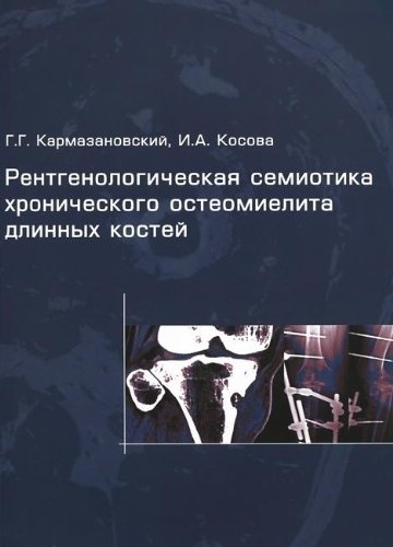 Рентгенологическая семиотика хронического остеомиелита длинных костей