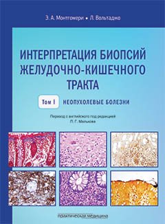 Интерпрет.биопсий желуд-киш.тракта.Т.1.Неопух.бол