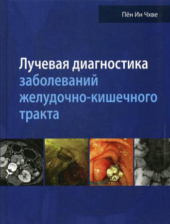 Лучевая диагност.заболев.желудочно-кишечн.тракта