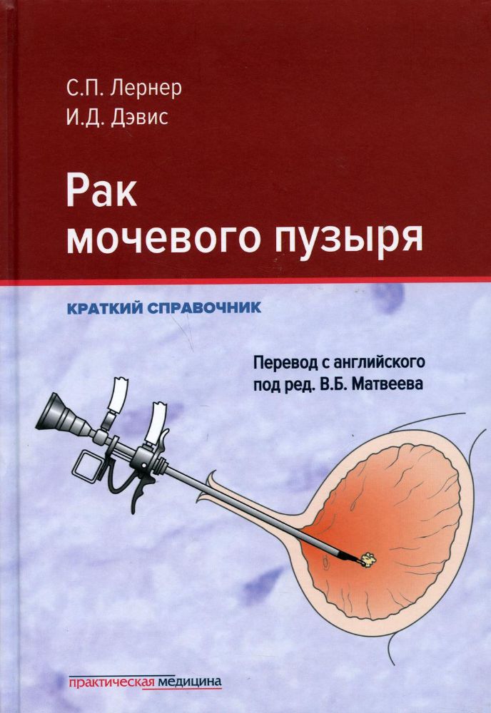 Рак мочевого пузыря.Краткий справочник