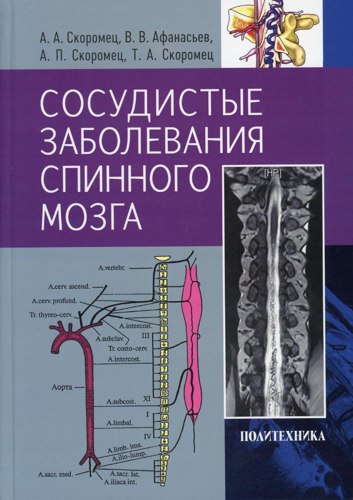 Сосудистые заболевания спинного мозга.Рук.д/врачей