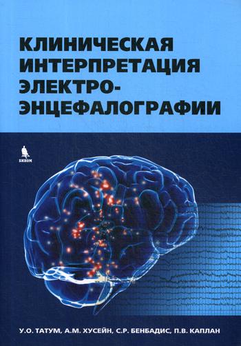 Клиническая интерпретация электроэнцефалографии