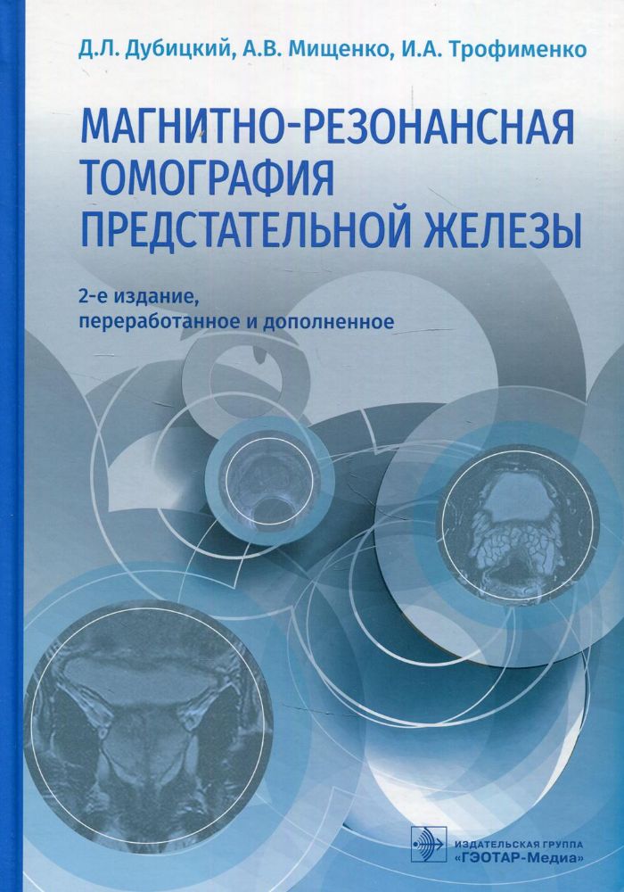 Магнитно-резонансная томография предстательной железы