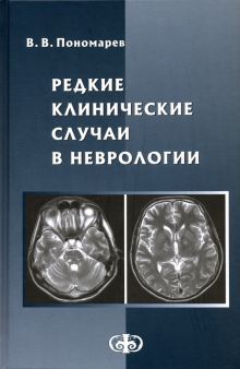 Редкие клинические случаи в неврологии. Руковод-во