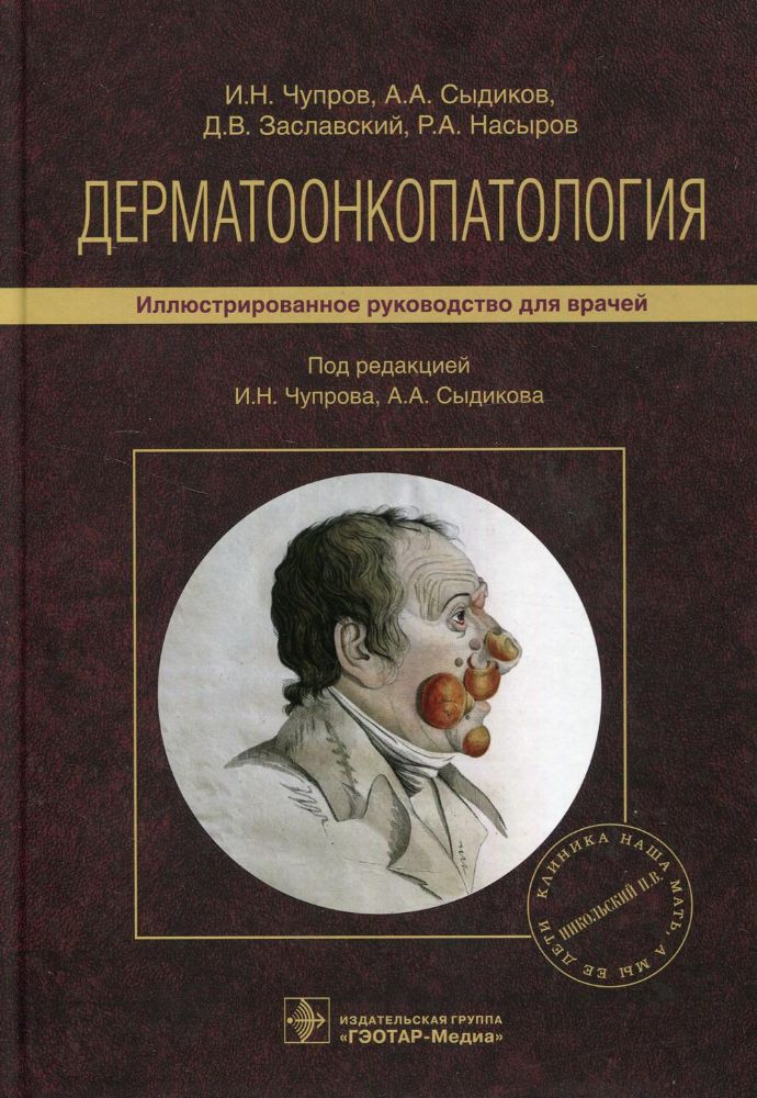 Дерматоонкопатология.Иллюстрир.руководство для врачей