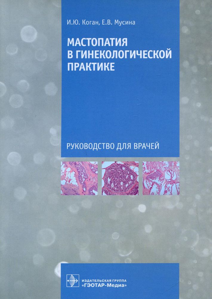 Мастопатия в гинекологической практике