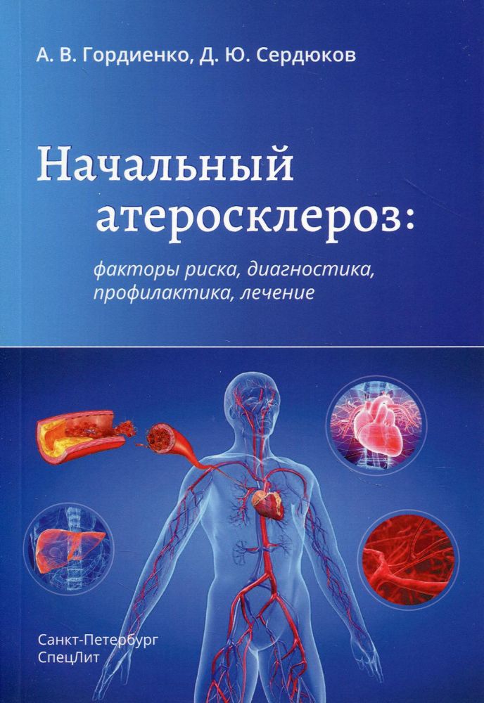 Начальный атеросклероз: факторы риска, диагностика, профилактика, лечение