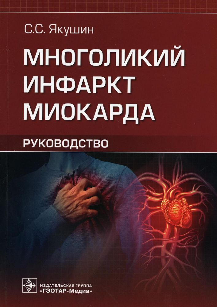 Многоликий инфаркт миокарда:руководство