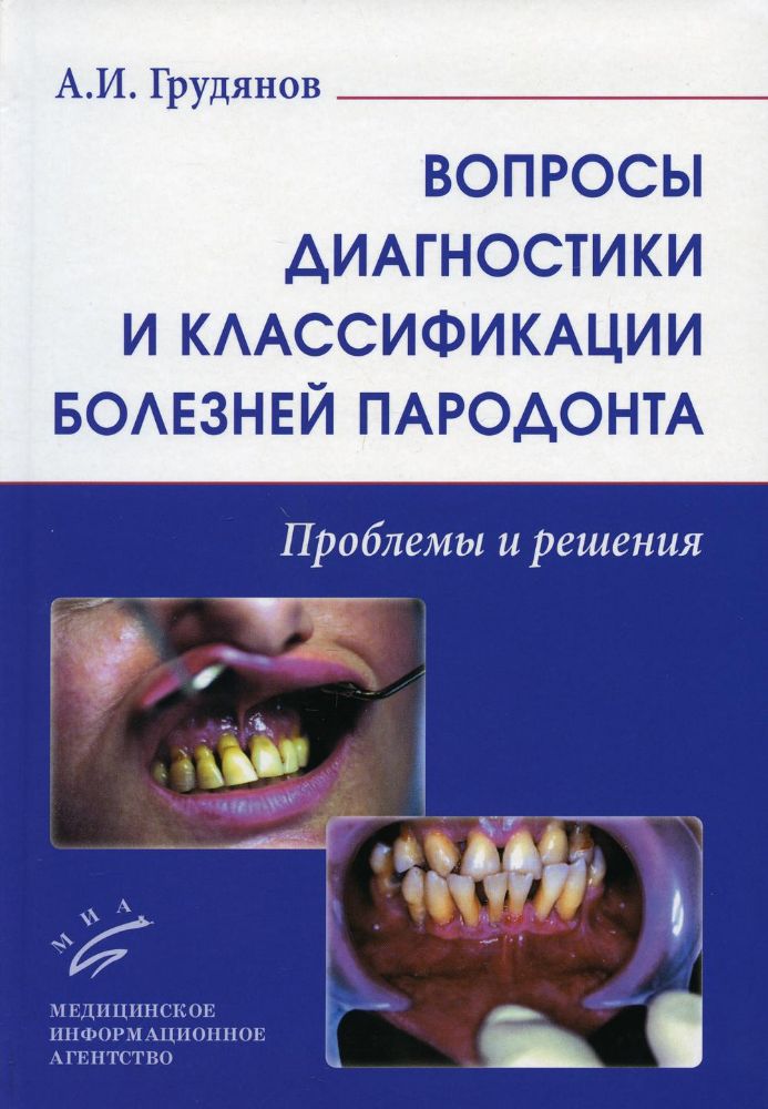 Вопросы диагностики и классификации болезней пародонта. Проблемы и решения