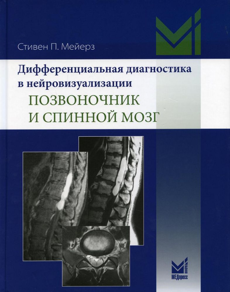 Дифференциальная диагностика в нейровизуализации. Позвоночник и спинной мозг