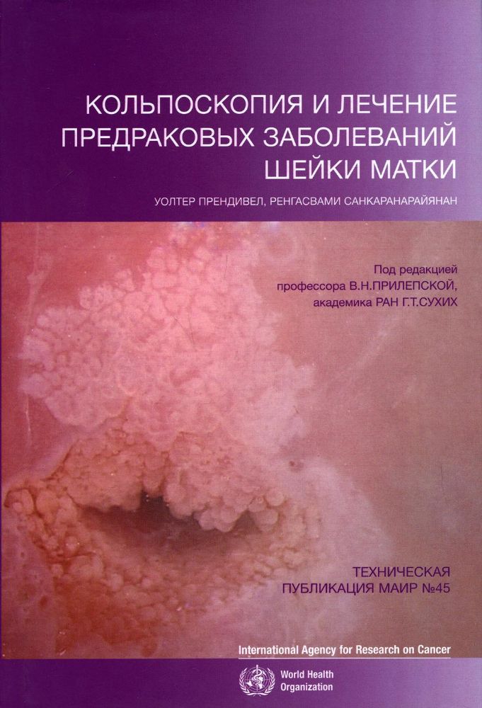 Кольпоскопия и лечение предраковых заболеваний шейки матки