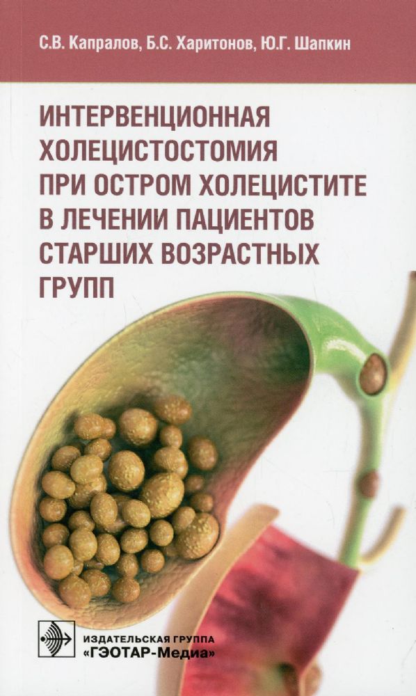 Интервенционная холецистостомия при остр.холецистите в лечении пациентов старш.в