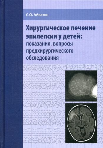 Хирургическое лечение эпилепсии у детей: показания, вопросы предхирургического обследования