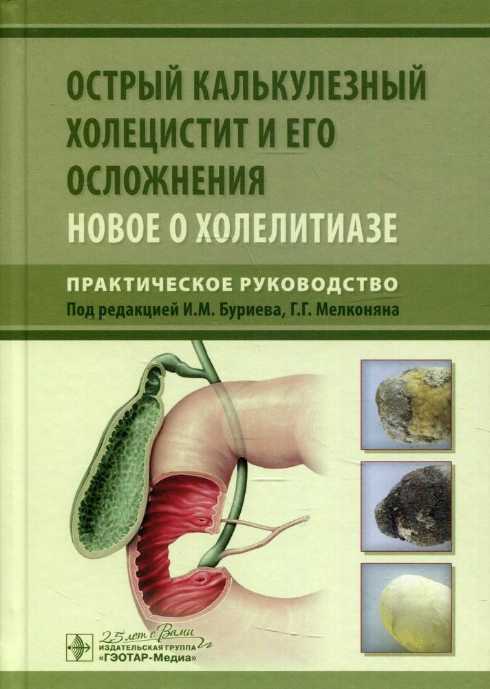 Острый калькулезный холецистит и его осложнения. Новое о холелитиазе. Практическое руководство