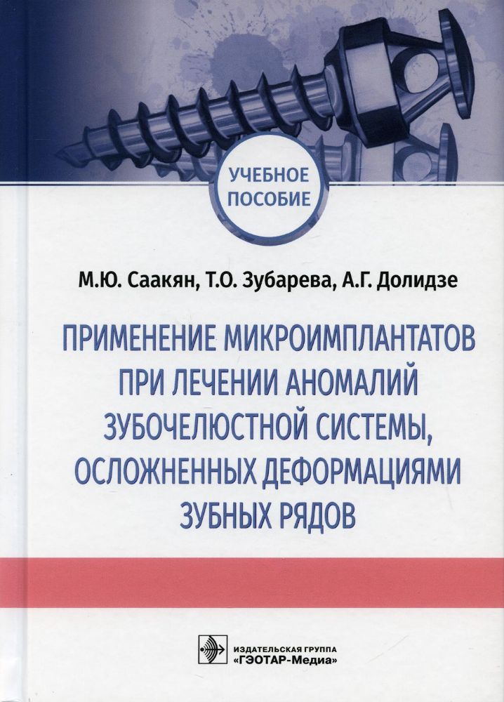 Применение микроимплантатов при лечении аномалий зубочелюст.системы,осложнен.деф