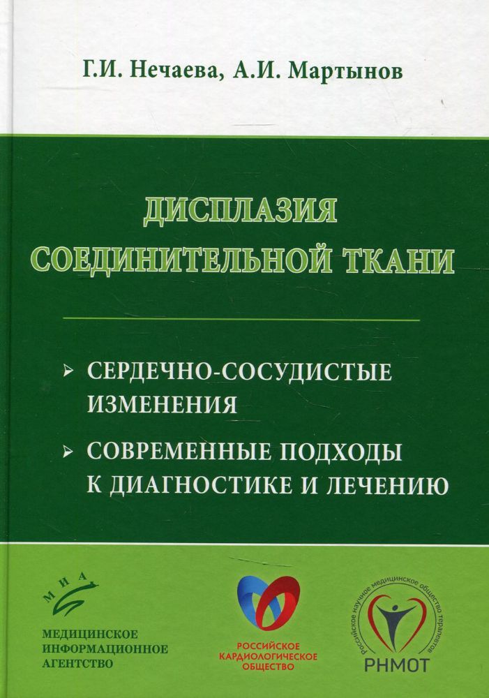 Дисплазия соединительной ткани: сердечно-сосудистые изменения, современные подходы к диагностике и лечению