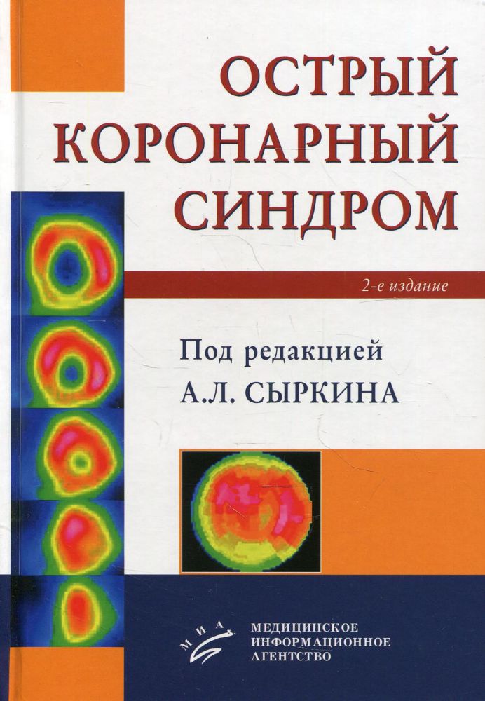 Острый коронарный синдром. 2-е изд., доп. и перераб