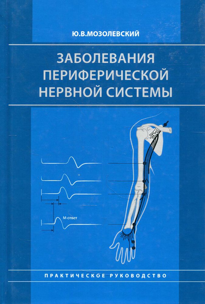 Заболевания периферической нервной системы. Практическое руководство