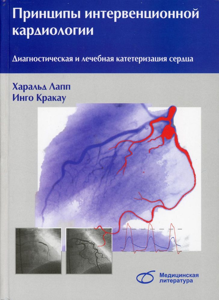 Принципы интервенционной кардиологии. Диагностическая и лечебная катетеризация сердца