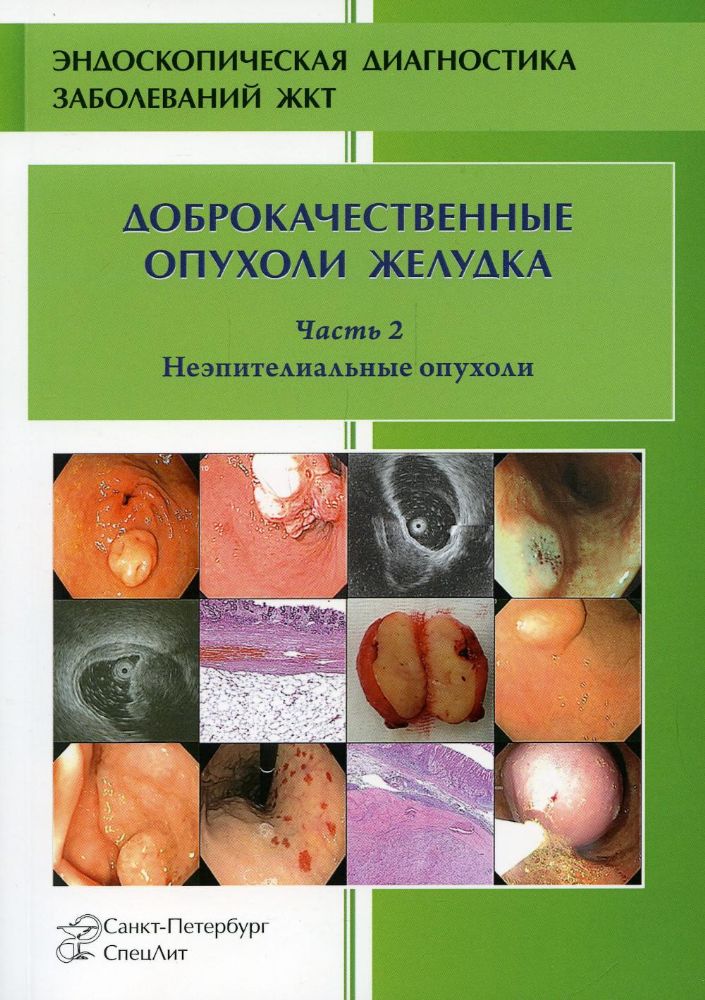 Доброкачественные опухоли желудка. Неэпителиальные  опухоли. Ч. 2: Учебно-методическое пособие