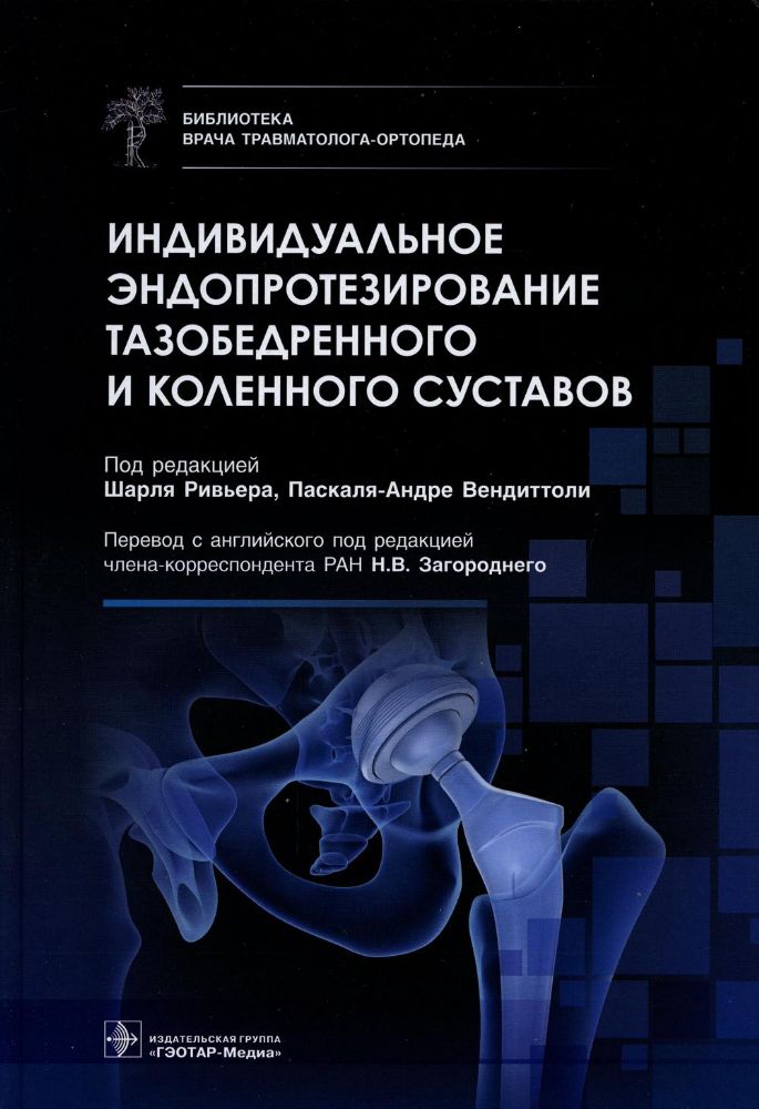 Индивидуальное эндопротезирование тазобедренного и коленного суставов