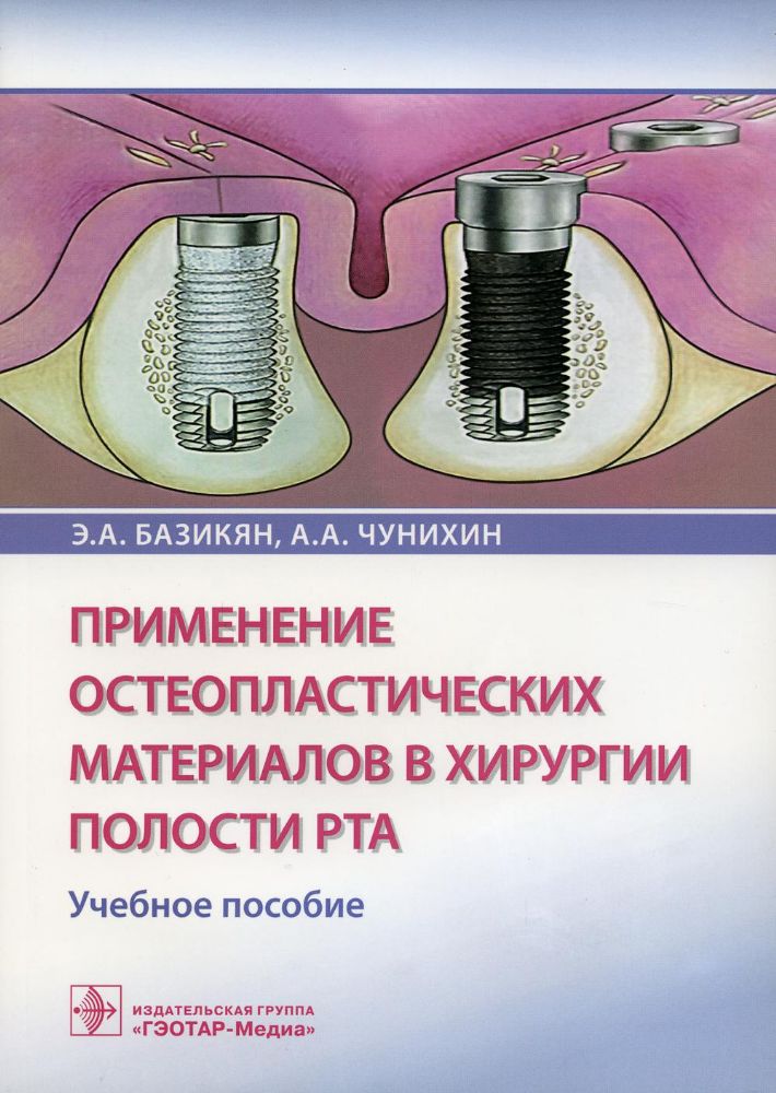 Применение остеопластических материалов в хирургии полости рта : учебное пособие / Э. А. Базикян, А. А. Чунихин. — М. : ГЭОТАР-Медиа, 2023. — 152 с. :