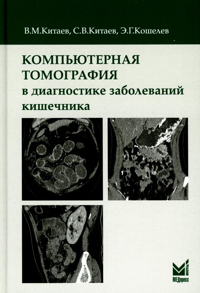 Компьютерная томография в диагностике заболеваний кишечника