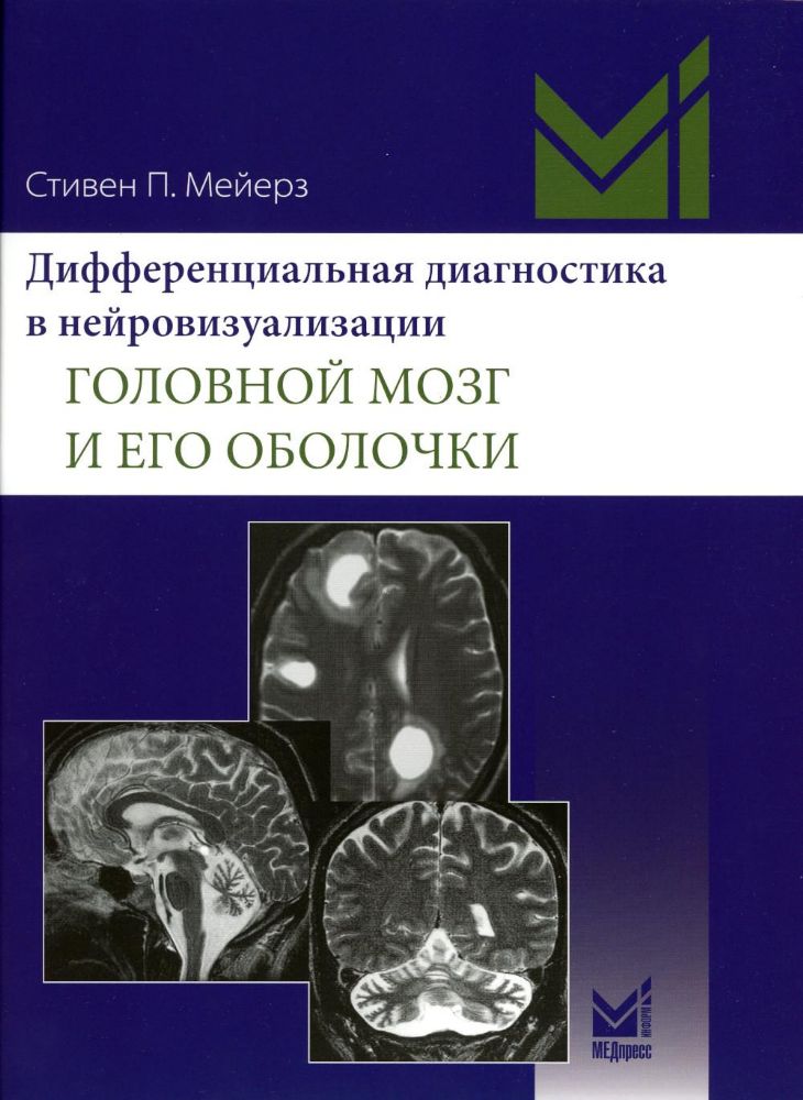 Дифференциальная диагностика в нейровизуализации. Головной мозг и его оболочки.