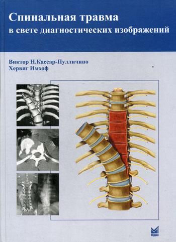 Спинальная травма в свете диагностических изображений
