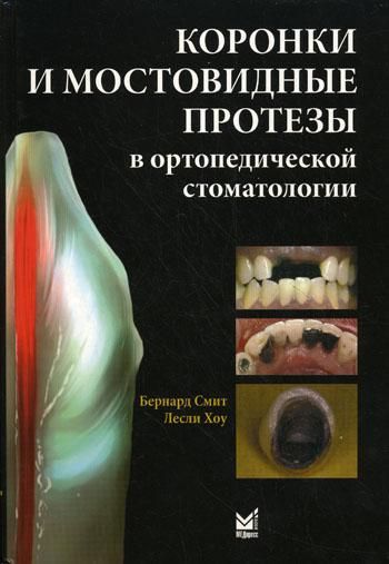 Коронки и мостовидные протезы в ортопедической стоматологии