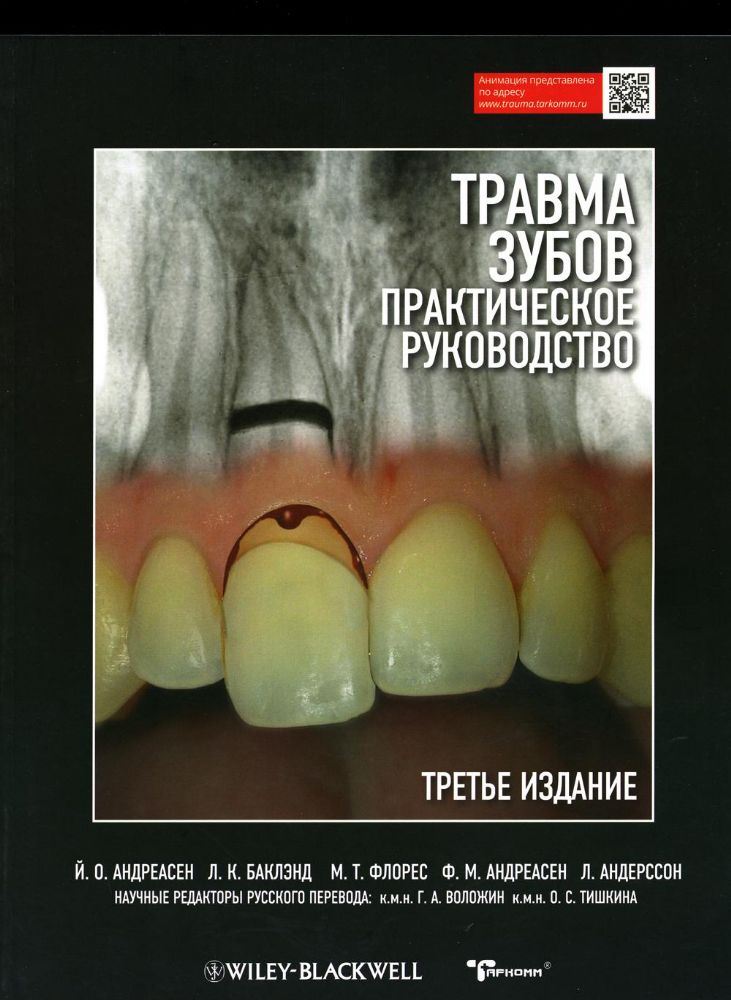 Травма зубов. Практическое руководство - Й.О. Андреасен, Л.К. Баклэнд, М.Т. Флорес, Ф.М. Андреасен, Л. Андерссон (перевод с английского под ред. Г. Во