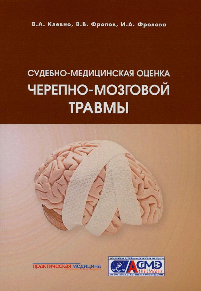 Судебно-медицинская оценка черепно-мозговой травмы