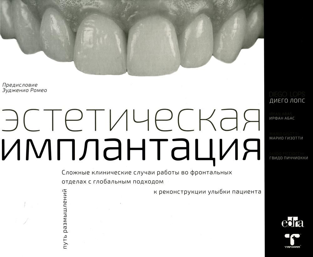 Эстетическая имплантация. Сложные клинические случаи работы во фронтальных отделах с глобальным подходом к реконструкции улыбки пациента М: ТАРКОММ 20