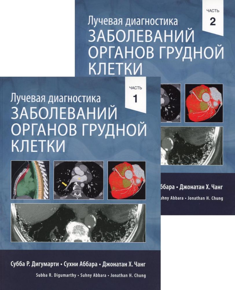 Лучевая диагностика заболеваний органов грудной клетки