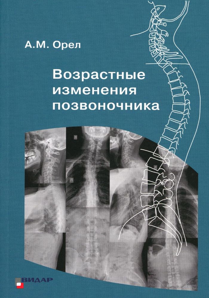 Возрастные изменения позвоночника Орел А.М.