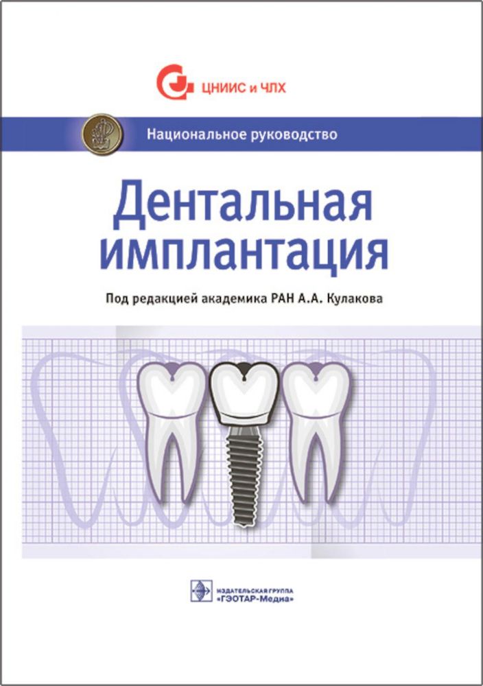 Дентальная имплантация : национальное руководство