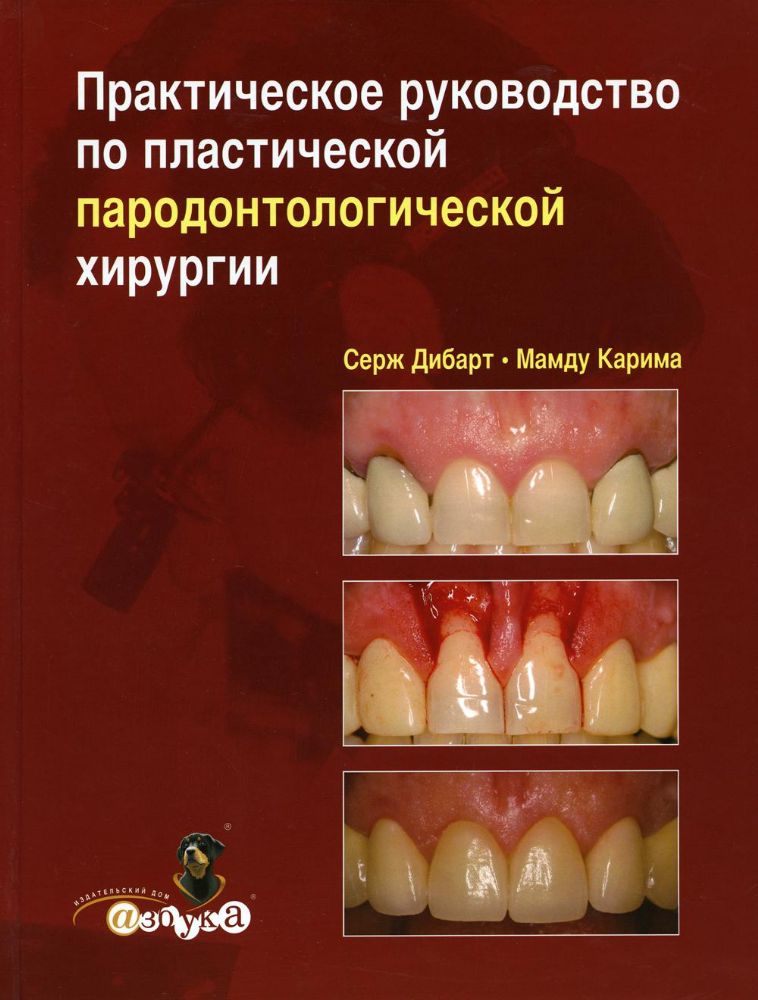 Серж Дибарт. Практическое руководство по пластической парадонтологической хирургии, М., 2007