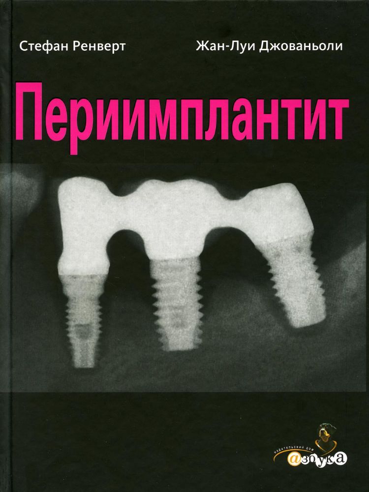 Стефан Ренверт, Жан-Луи Джованьоли Периимплантит, М., 2014, 255 стр., 1197 иллюстр.