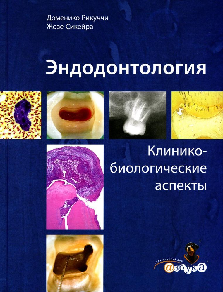 Рикуччи, Д. Эндодонтология. Клинико-биологические аспекты/Д.Рикуччи, Ж.Сикейра. - М., Азбука стоматолога, 2015.-415с.