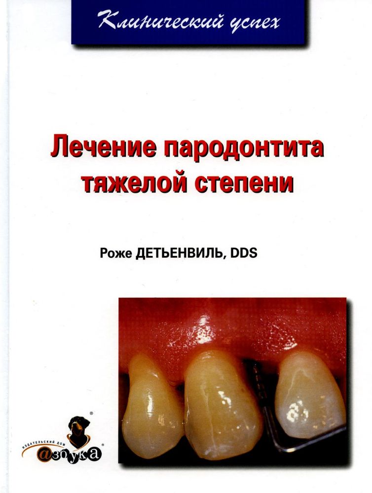 Роже Детьенвиль.Лечение пародонтита тяжелой степени. - М, 2007