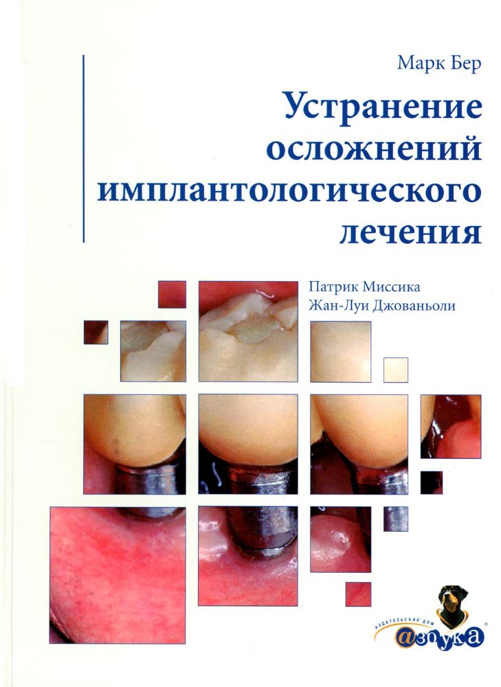 Марк Бер.Устранение осложнений имплантологического лечения, М., 2007