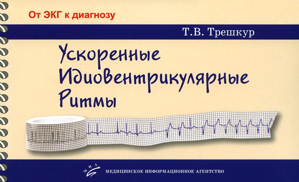 Ускоренные идиовентрикулярные ритмы: клинико-электрокардиографические особенности, систематизация по ЭКГ-характеристикам, дифференцирован