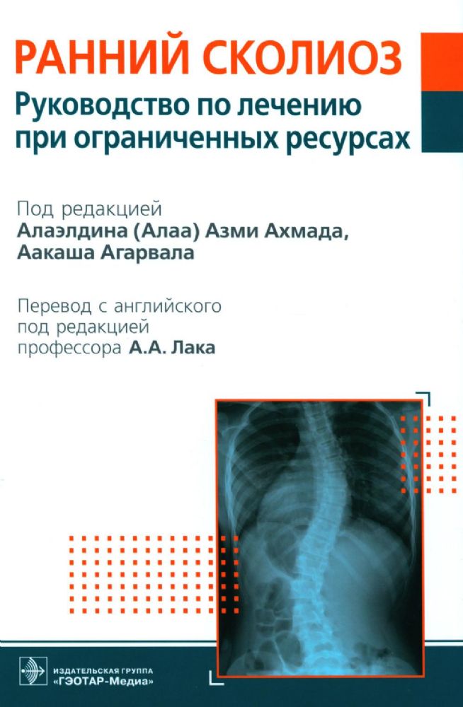 Ранний сколиоз.Руководство по лечению при ограниченных ресурсах