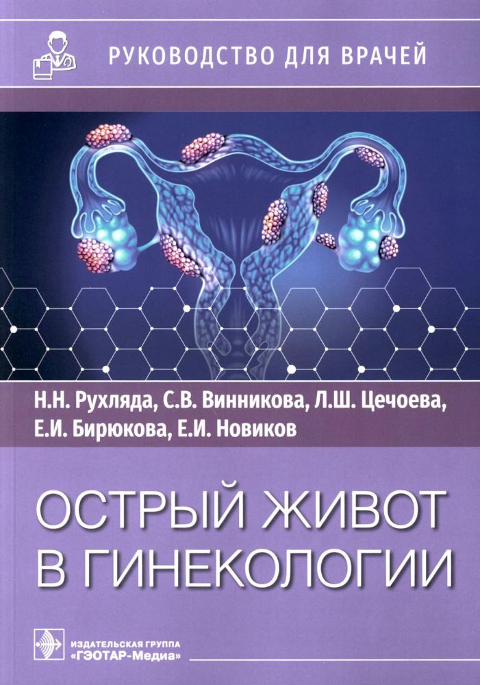 Острый живот в гинекологии: руководство для врачей