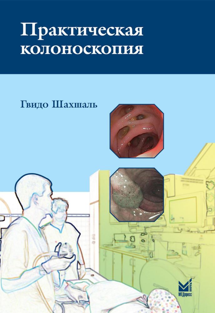 Практическая колоноскопия. Методика, рекомендации, советы и приемы. 3-е изд